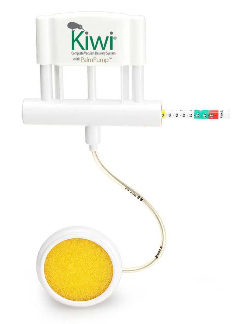 Kiwi® Complete Vacuum Delivery System Laborie