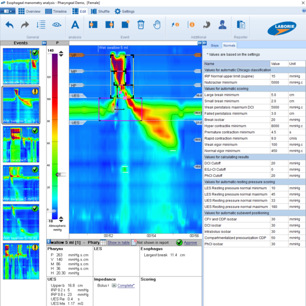 Solar™ GI HighResolution Pharyngeal Manometry Laborie
