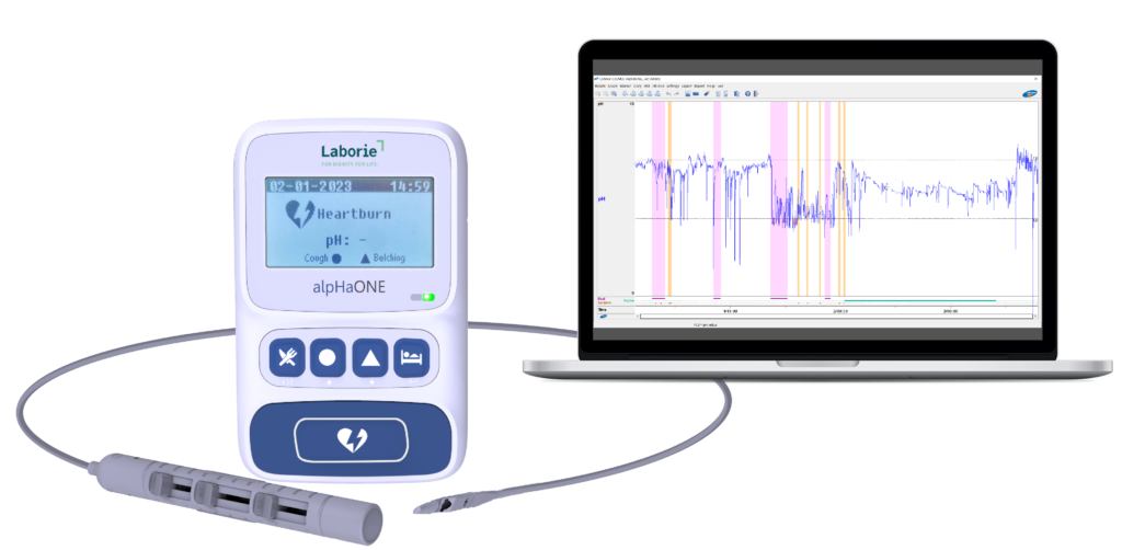 alpHaONE Wireless pH Capsule Reflux Monitoring System for the Treatment of GERD