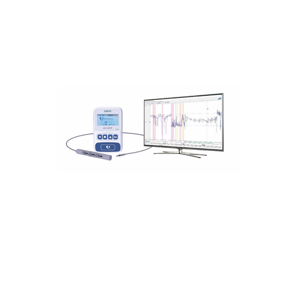 AlphaOne Image