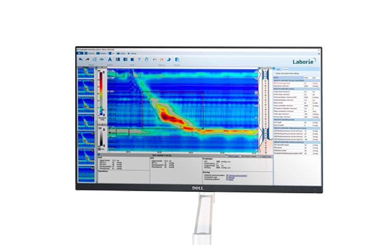 a dell computer monitor displays a laborie program