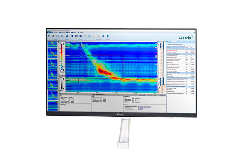 a dell computer monitor displays a laborie program